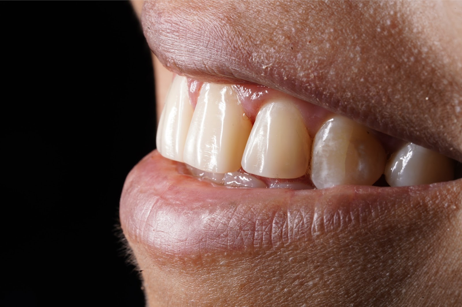 Northsmile